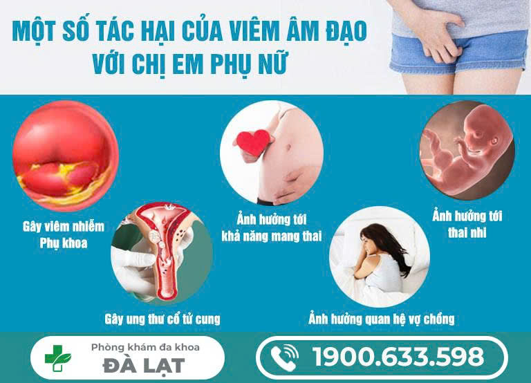 Hình ảnh minh họa